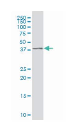 MFNG O-fucosylpeptide 3-beta-N-acetylglucosaminyltransferase, Mouse, Polyclonal