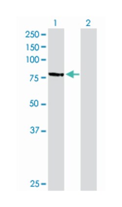 membrane protein, palmitoylated 3 (MAGUK p55 subfamily member 3), Rabbit,