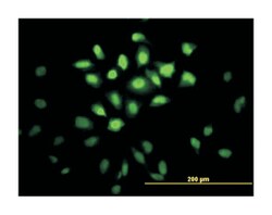 musashi homolog 1 (Drosophila), Mouse, Clone: 3F2, Abnova 100 &mu;g | Buy Online | Abnova Corporation | Fisher Scientific