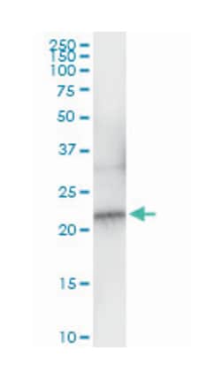 NDUFB10, Rabbit, MaxPab Polyclonal Antibody, Abnova 100&mu;L; Unlabeled:Antibodies,