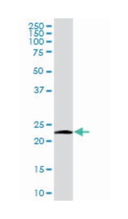 NDUFV2, Mouse, Purified MaxPab Polyclonal Antibody, Abnova 50&mu;g; Unlabeled:Antibodies,
