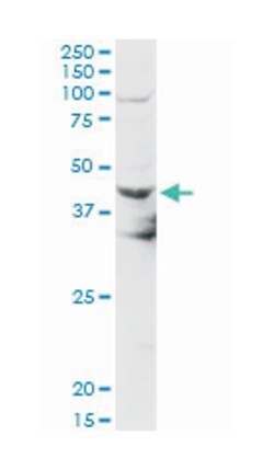 NEU2, Mouse, Polyclonal Antibody, Abnova 50&mu;L; Unlabeled:Antibodies,