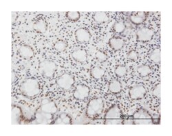 NFKB1, Mouse, Clone: 4A11, Abnova 100&mu;g; Unlabeled:Antibodies, Monoclonal
