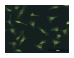 nonmetastatic cells 1, protein (NM23A) expressed in, Rabbit, Purified MaxPab Polyclonal Antibody, Abnova 100 &mu;g | Buy Online | Abnova | Fisher Scientific