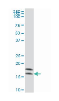 nonmetastatic cells 2, protein (NM23B) expressed in, Mouse, Clone: 1D3, Abnova 100 &mu;g | Buy Online | Abnova Corporation | Fisher Scientific
