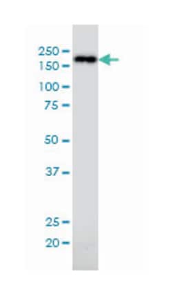nuclear mitotic apparatus protein 1, Mouse, Clone: 1C5, Abnova™