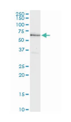 NR4A2, Mouse, Clone: 2A3, Abnova 100 &mu;g | Buy Online | Abnova Corporation | Fisher Scientific