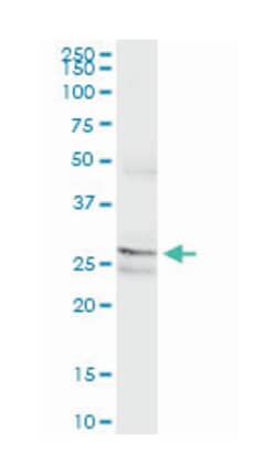 PAFAH1B2, Mouse, Clone: 2F4-1C10, Abnova 200&mu;L; Unlabeled:Antibodies,