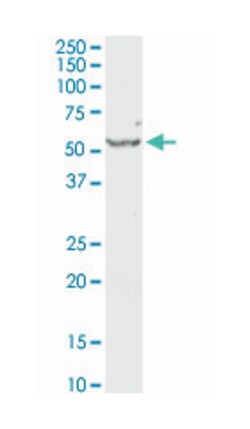 serpin peptidase inhibitor, clade E (nexin, plasminogen activator inhibitor