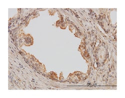 p21 protein (Cdc42/Rac)-activated kinase 1, Mouse, Clone: 1E11, Abnova