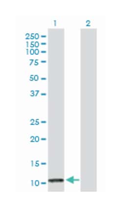 platelet factor 4, Rabbit, Purified MaxPab Polyclonal Antibody, Abnova 100 &mu;g | Buy Online | Abnova | Fisher Scientific