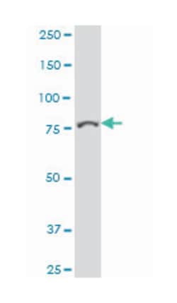 protein tyrosine phosphatase, receptor type, E, Mouse, Polyclonal Antibody, Abnova 50 &mu;L | Buy Online | Abnova | Fisher Scientific