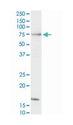 v-raf-1 murine leukemia viral oncogene homolog 1, Mouse, Clone: 1H4, Abnova 100 &mu;g | Buy Online | Abnova | Fisher Scientific
