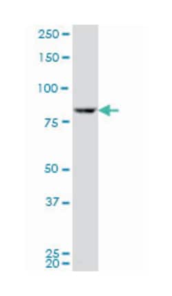 ribosomal protein S6 kinase, 90kDa, polypeptide 3 (A01), Mouse anti-Human,