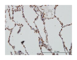 serum/glucocorticoid regulated kinase 1, Mouse, Clone: 3E3, Abnova 100 &mu;g | Buy Online | Abnova Corporation | Fisher Scientific