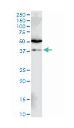 SIAH1, Mouse, Clone: 2C5, Abnova 100 &mu;g | Buy Online | Abnova Corporation | Fisher Scientific