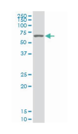 SWI/SNF related, matrix associated, actin dependent regulator of chromatin,