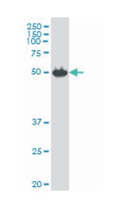 zinc finger protein 85, Mouse, Polyclonal Antibody, Abnova 50 &mu;L | Buy Online | Abnova Corporation | Fisher Scientific