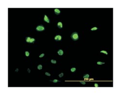 inhibitor of DNA binding 1, dominant negative helix-loop-helix protein,