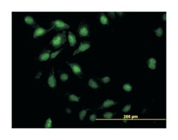 inhibitor of DNA binding 3, dominant negative helix-loop-helix protein,