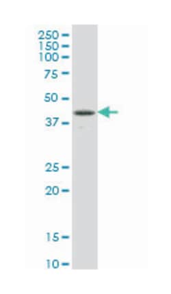 RBPJ, Mouse, Clone: 4E12, Abnova 200 &mu;L | Buy Online | Abnova | Fisher Scientific