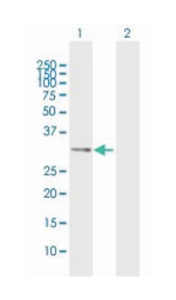 IL1B, Rabbit, MaxPab Polyclonal Antibody, Abnova 100&mu;L; Unlabeled:Antibodies,