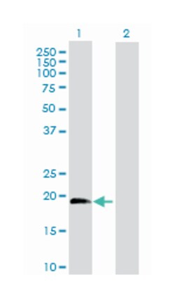interleukin 1 receptor antagonist, Rabbit, Purified MaxPab Polyclonal Antibody,