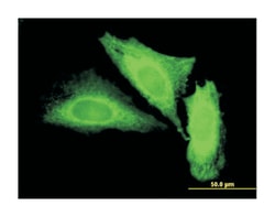 IL6, Mouse, Clone: 1G8, Abnova 100 &mu;g | Buy Online | Abnova Corporation | Fisher Scientific