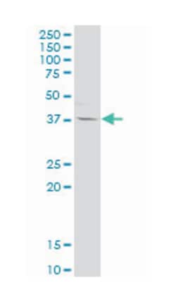 interleukin 12B (natural killer cell stimulatory factor 2, cytotoxic lymphocyte