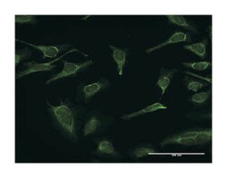 inositol(myo)-1(or 4)-monophosphatase 1, Rabbit, Purified MaxPab™ Polyclonal Antibody, Abnova™