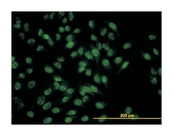 inhibitor of growth family, member 2 (B01), Mouse anti-Human, Polyclonal