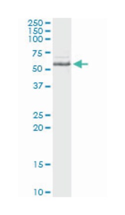 inositol polyphosphate-5-phosphatase, 40kDa, Mouse, Clone: 3D8, Abnova