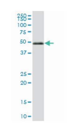 interferon regulatory factor 3, Mouse, Polyclonal Antibody, Abnova 50&mu;L;