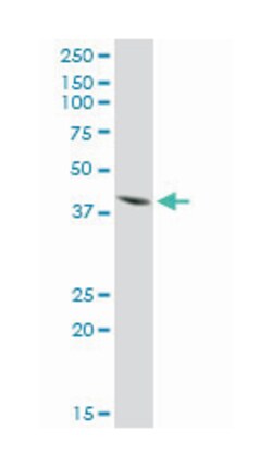 ISL LIM homeobox 1, Rabbit, Purified MaxPab Polyclonal Antibody, Abnova