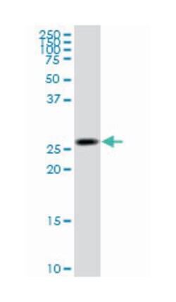 ketohexokinase (fructokinase), Mouse, Clone: 1H6-2B6, Abnova 100&mu;g;