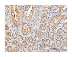 KLK2, Mouse, Polyclonal Antibody, Abnova 50&mu;L; Unlabeled:Antibodies,