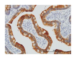 keratin 17, Mouse, Clone: 2D10, Abnova&trade;