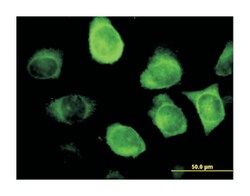 keratin 18, Mouse, Clone: 1G8, Abnova 100&mu;g; Unlabeled:Antibodies, Monoclonal