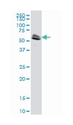 lymphocyte-specific protein tyrosine kinase, Mouse, Clone: 8B10, Abnova&trade;