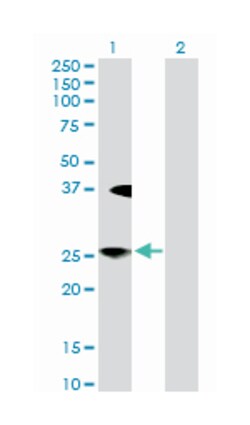 LFNG O-fucosylpeptide 3-beta-N-acetylglucosaminyltransferase, Rabbit, Purified MaxPab Polyclonal Antibody, Abnova 100 &mu;g | Buy Online | Abnova | Fisher Scientific
