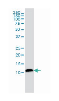 LGALS1, Mouse, Clone: 1E8-1B2, Abnova 200 &mu;L | Buy Online | Abnova Corporation | Fisher Scientific