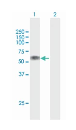 LTBR, Mouse, Polyclonal Antibody, Abnova 50 &mu;g | Buy Online | Abnova Corporation | Fisher Scientific