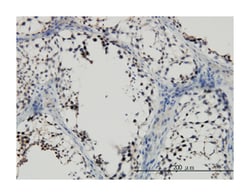 SMAD family member 2, Mouse, Clone: 3G9, Abnova&trade;