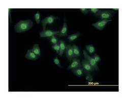 nuclear factor of kappa light polypeptide gene enhancer in B-cells 1, Mouse,