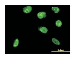 nescient helix loop helix 2, Mouse, Clone: 3D5, Abnova 100&mu;g; Unlabeled:Antibodies,