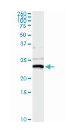 nonmetastatic cells 1, protein (NM23A) expressed in, Mouse, Clone: 1D7,