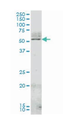 NR4A2, Mouse, Clone: 1G6, Abnova 200μL; Unlabeled:Antibodies, Monoclonal