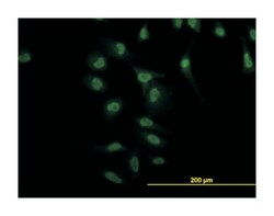 NR4A2, Mouse, Clone: 1C6, Abnova 100&mu;g; Unlabeled:Anticuerpos