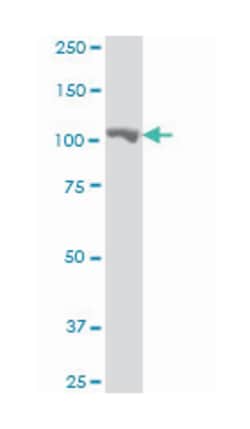 methionyl-tRNA synthetase, Mouse, Clone: 5G5, Abnova 100&mu;g; Unlabeled:Anticuerpos