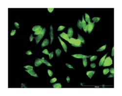malic enzyme 1, NADP(+)-dependent, cytosolic, Rabbit, Purified MaxPab Polyclonal